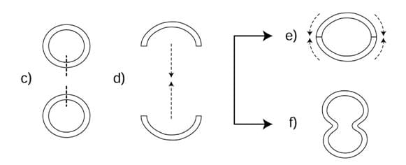 Slide Tracheoplasty-diagram